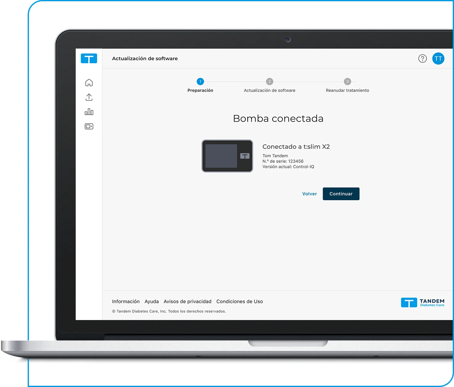 Tandem Source platform, Pump Connected screen