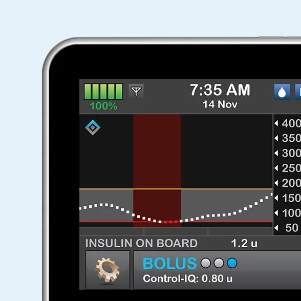 Control-IQ Technology