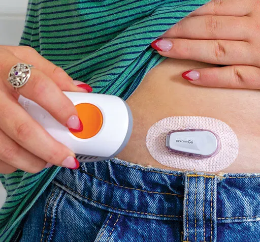 Dexcom user attaching the Dexcom G6