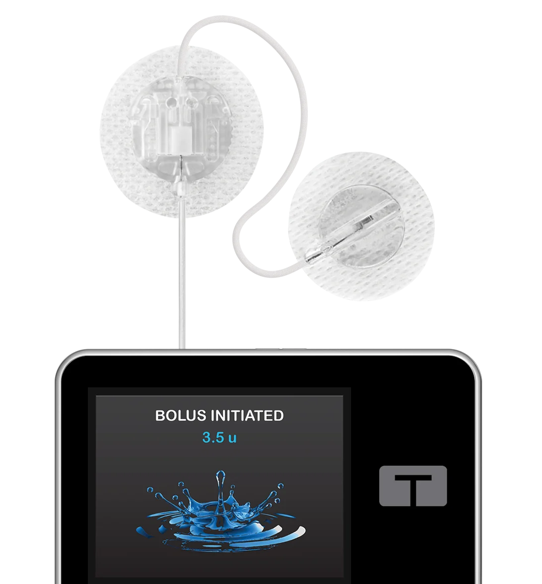 t:slim X2 Insulin Pump with TruSteel Infusion Set