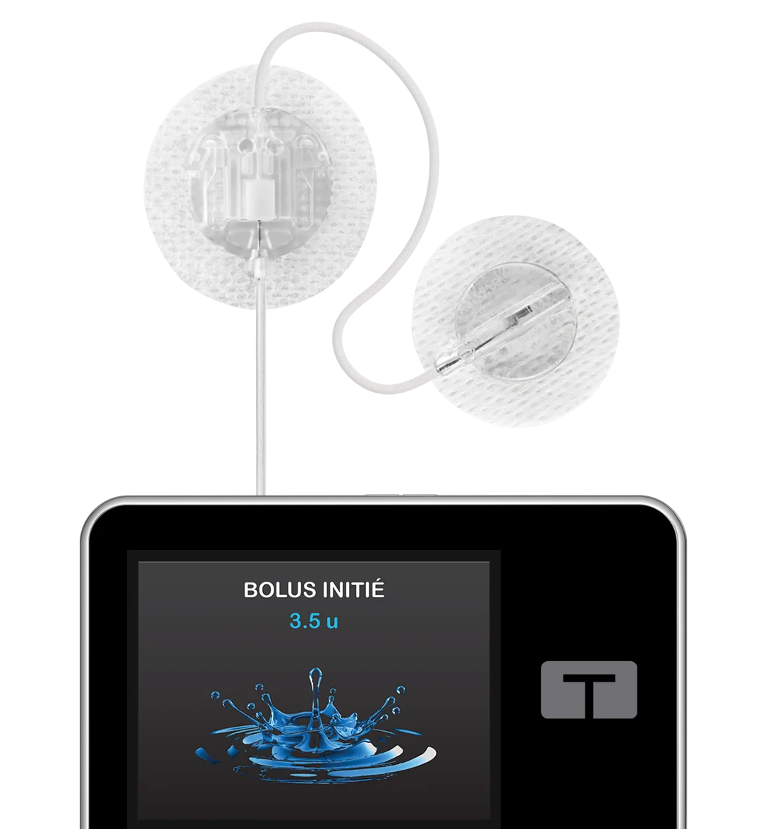 t:slim X2 + TruSteel