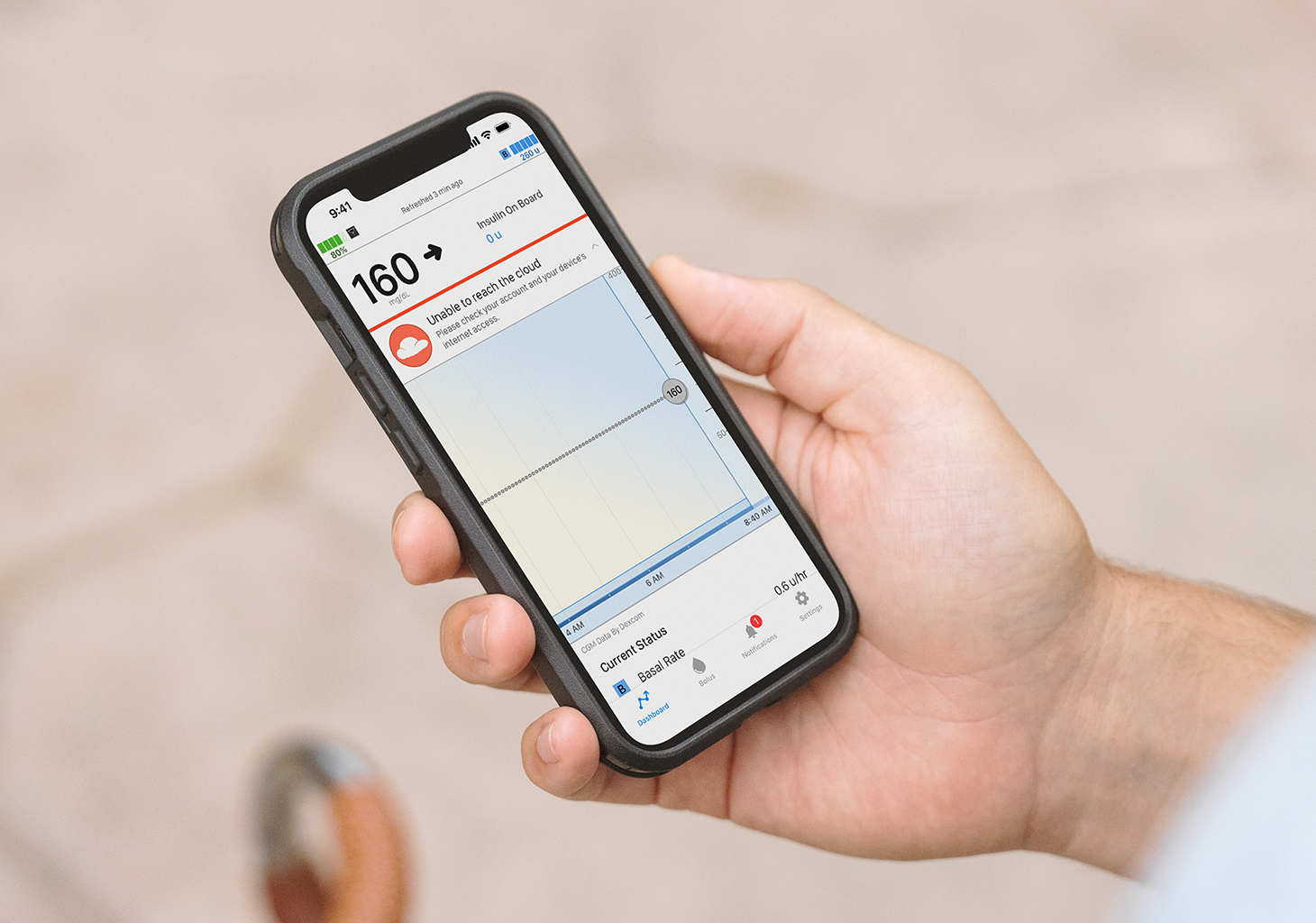 A person holding a smartphone displaying the Tandem Mobi app with a continuous glucose reading of 160 mg/dL and a red