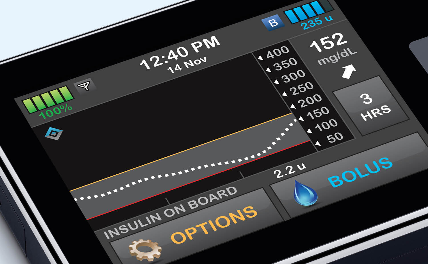 The screen of a t:slim X2 insulin pump showing a CGM trend line