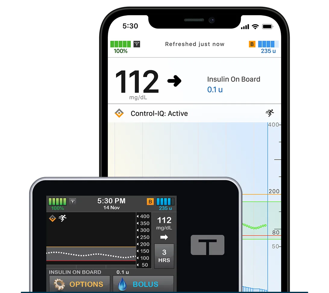 t:slim X2 insulin pump with mobile app