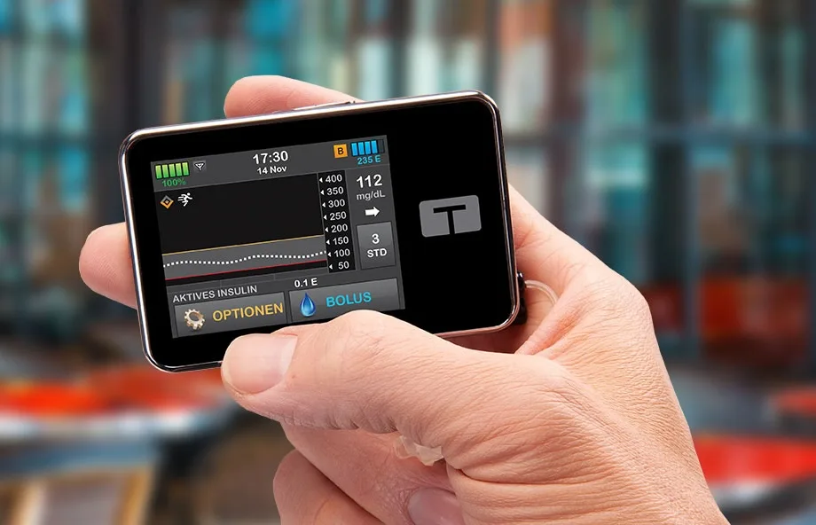 t:slim X2 insulin pump