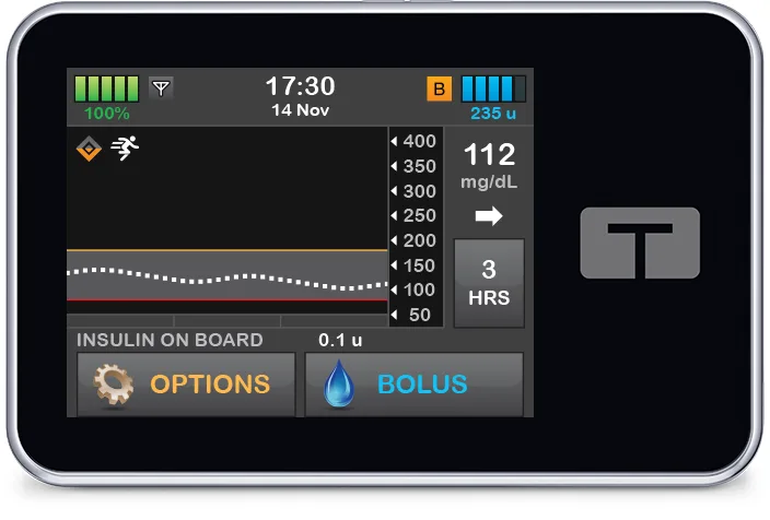 t:slim X2 Control-IQ Home Screen