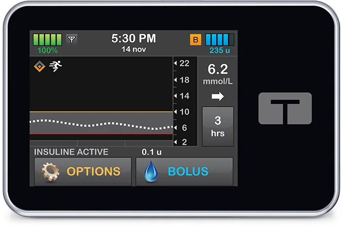 t:slim X2 Control-IQ Home Screen
