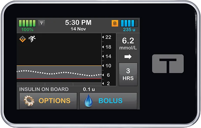 t:slim X2 Control-IQ Home Screen