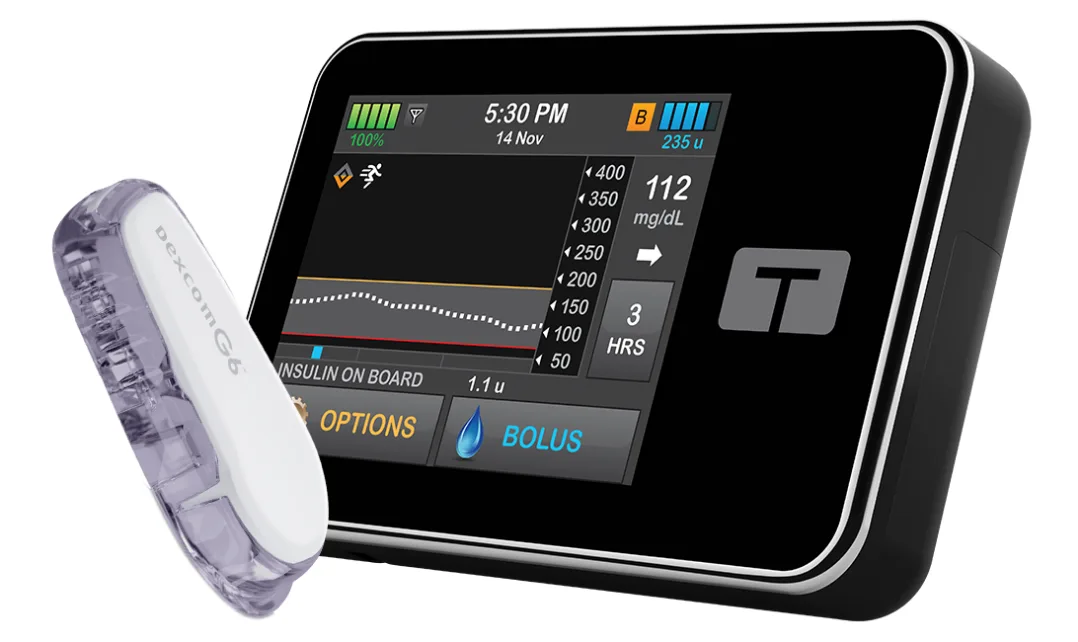 The t:slim X2 insulin pump with the dexcom G6