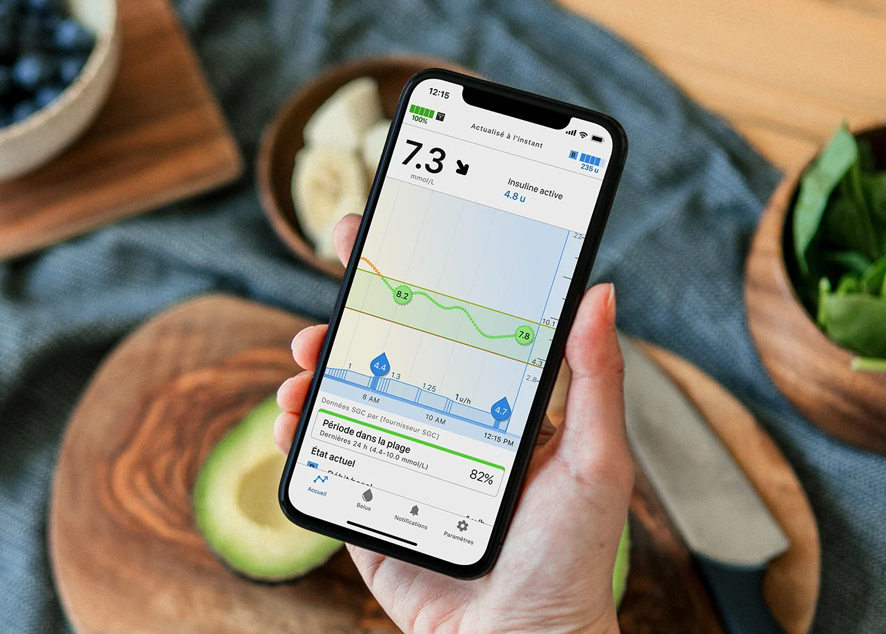 Tandem mobile app showing blood glucose reading in mmol/L