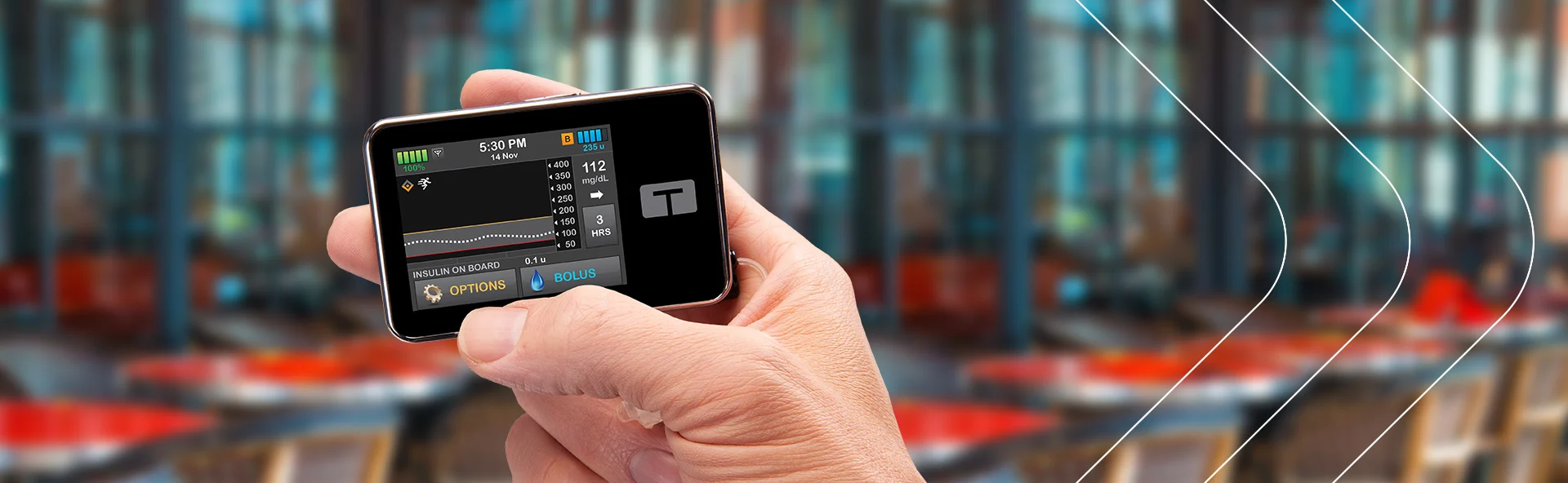 t:slim X2 insulin pump