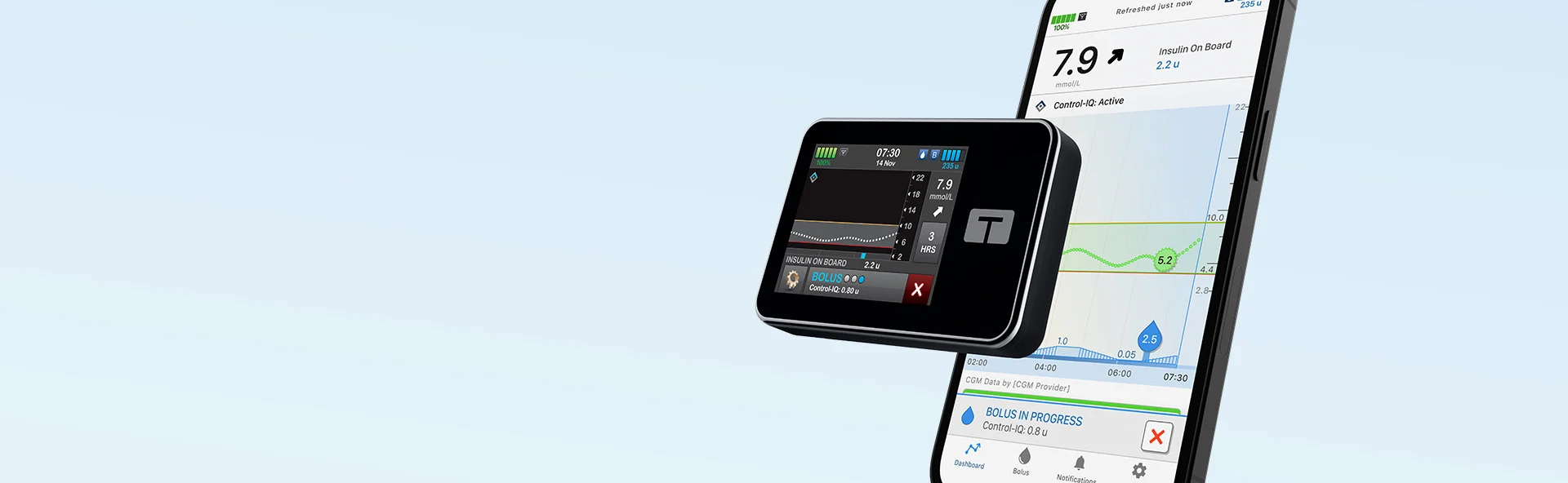 t:slim X2 insulin pump and Tandem t:slim mobile app