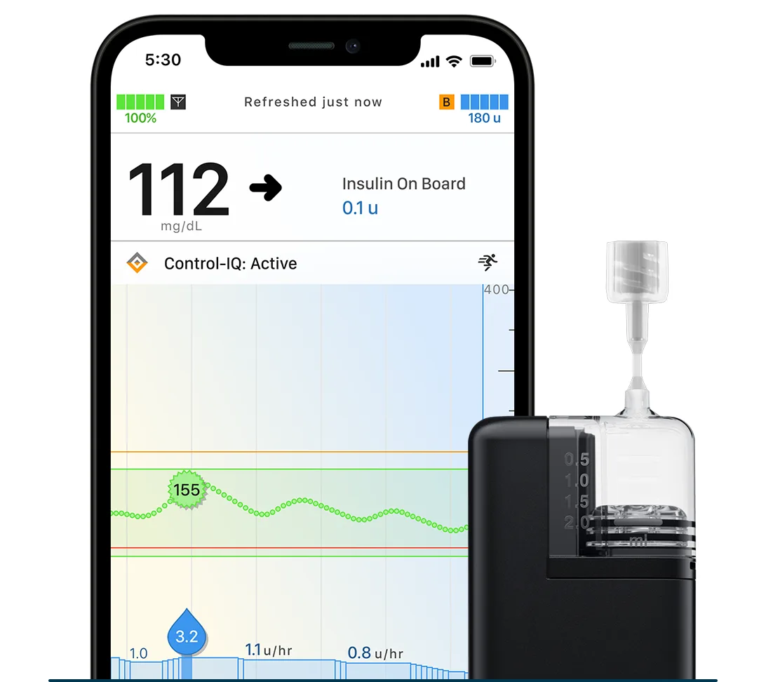 Tandem Mobi System with mobile app