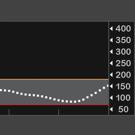 What is Time in Range and What Does it Mean for Diabetes Management?