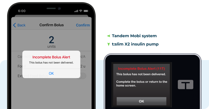 Incomplete Bolus Alert screen shown on the Tandem Mobi mobile app and on the t:slim X2 pump
