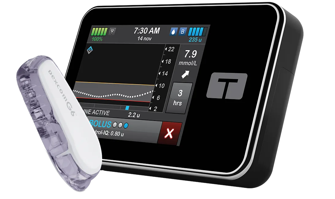 t:slim X2 pump with Dexcom G6