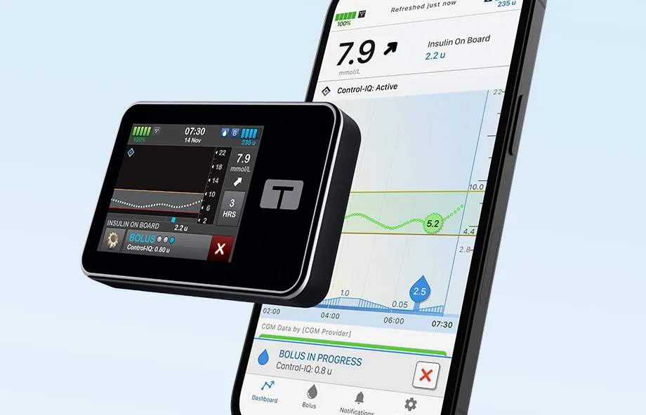t:slim X2 insulin pump and Tandem t:slim mobile app