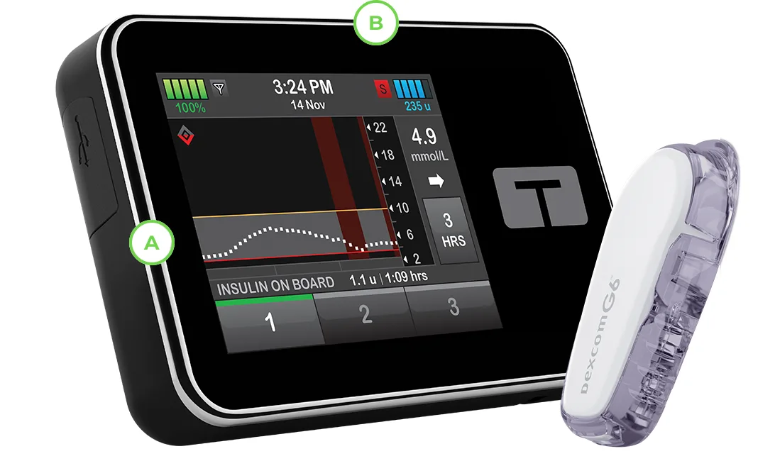 Basal-IQ Technology with Dexcom G6 CGM