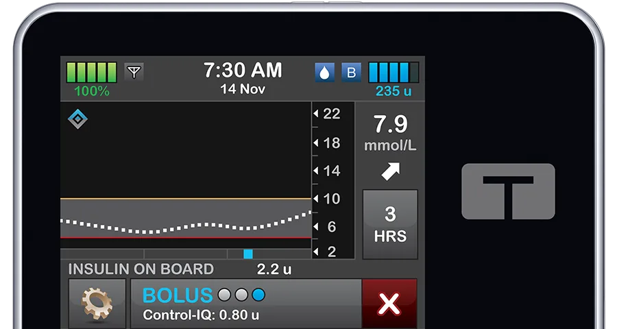t:slim X2 Insulin Pump
