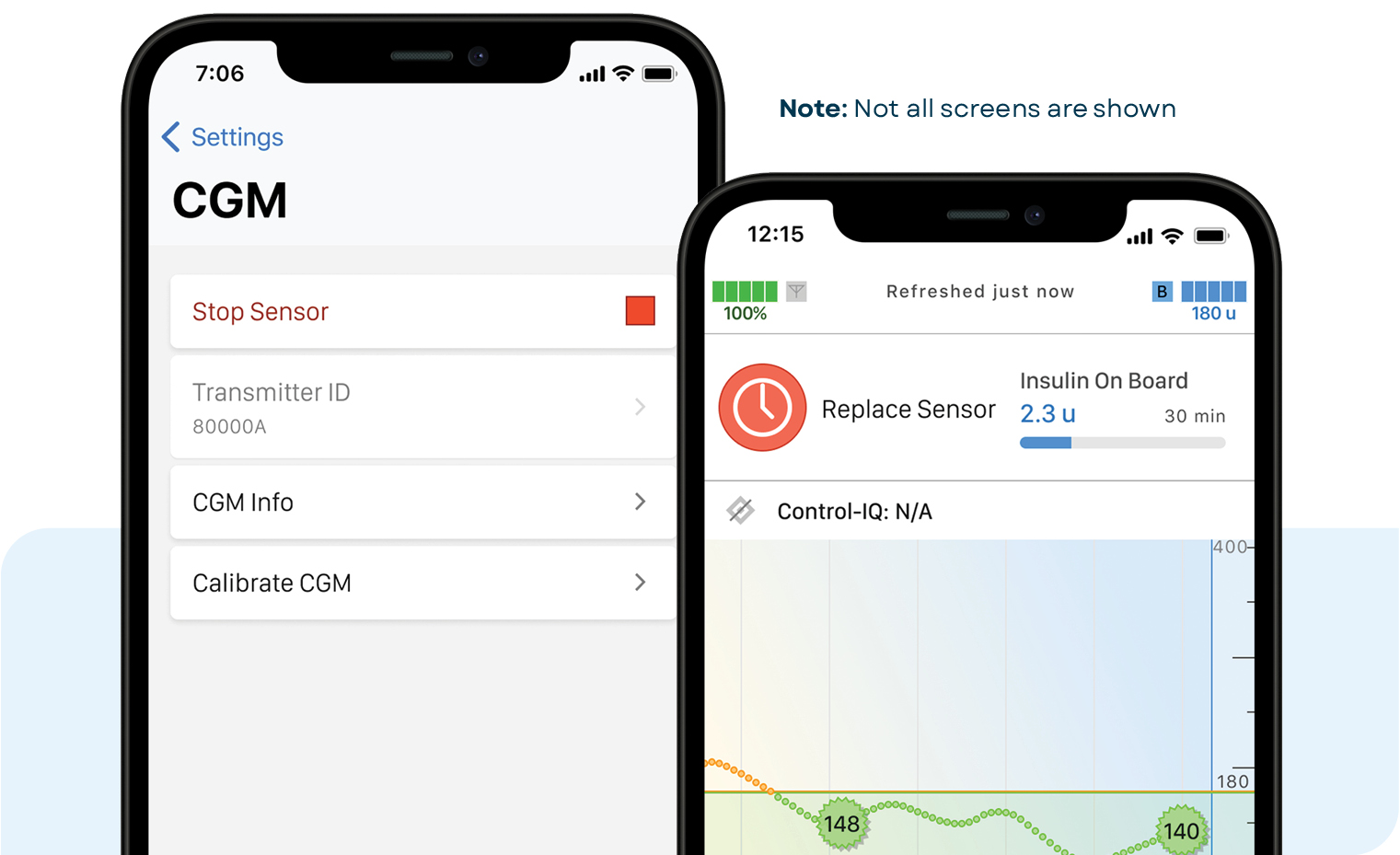 Stop and replace Dexcom G6 sensor