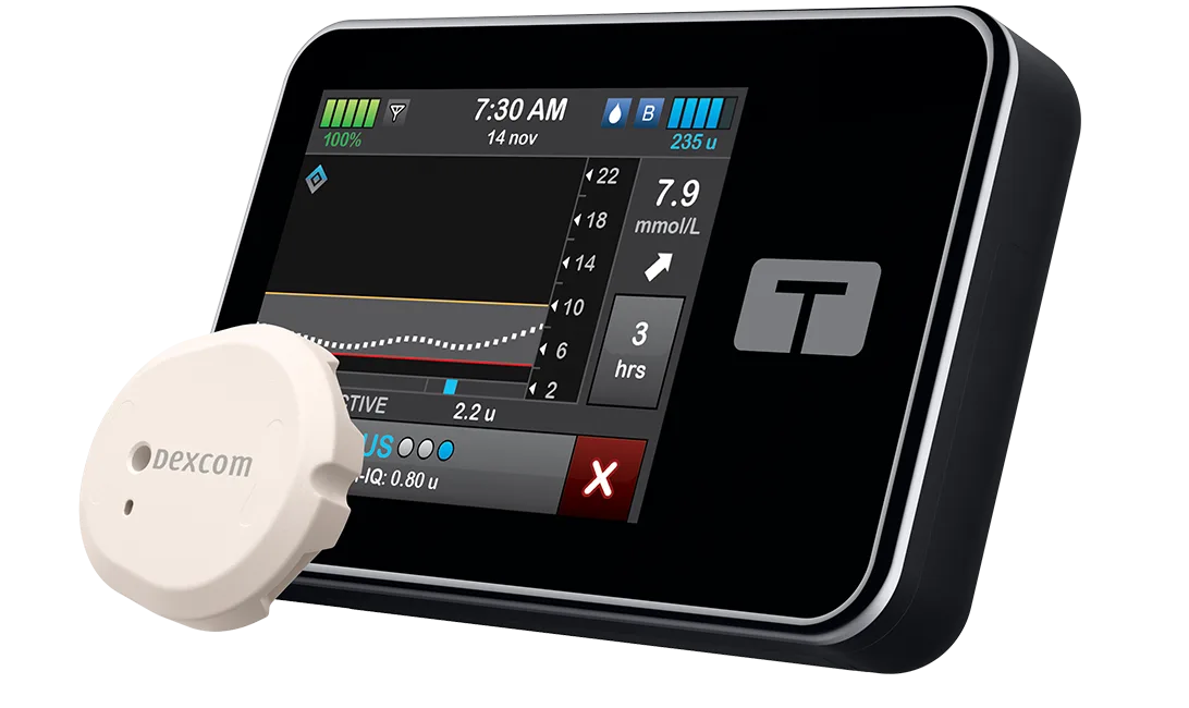 t:slim X2 insulin pump