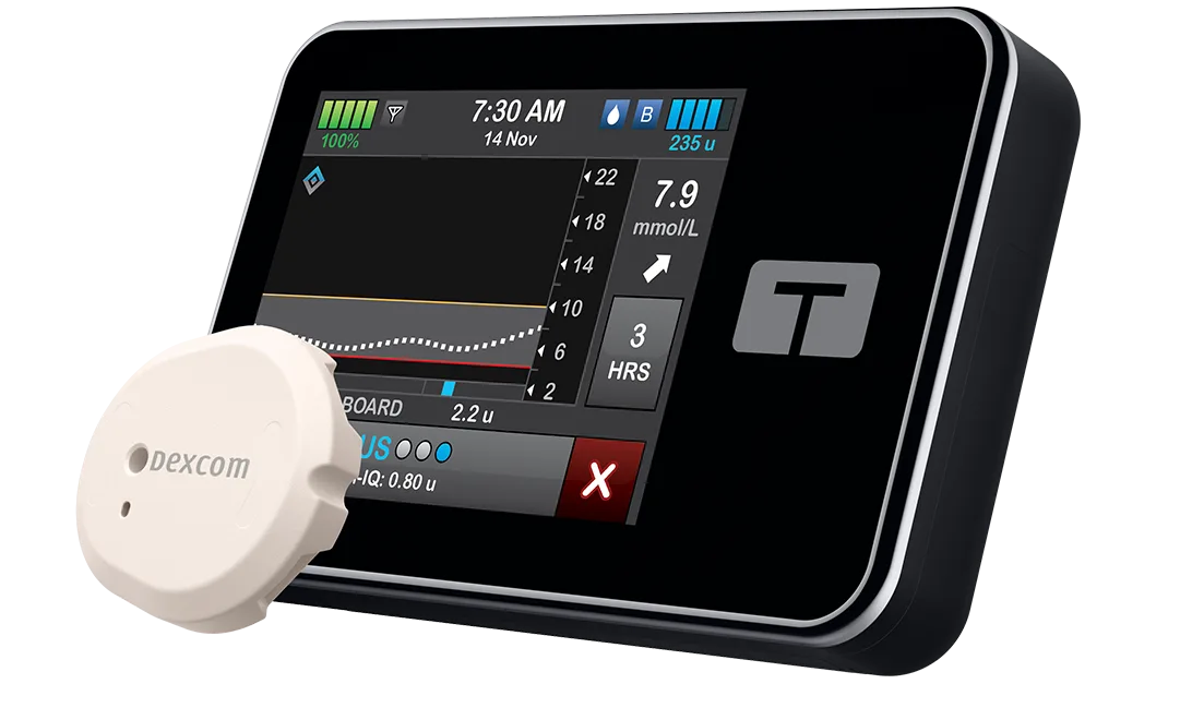 t:slim X2 insulin pump