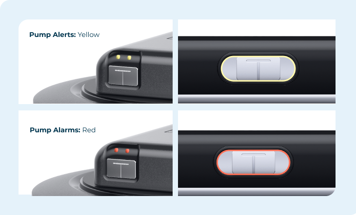 The LED lights on the t:slim X2 and Tandem Mobi display yellow for pump alerts and red for pump alarms