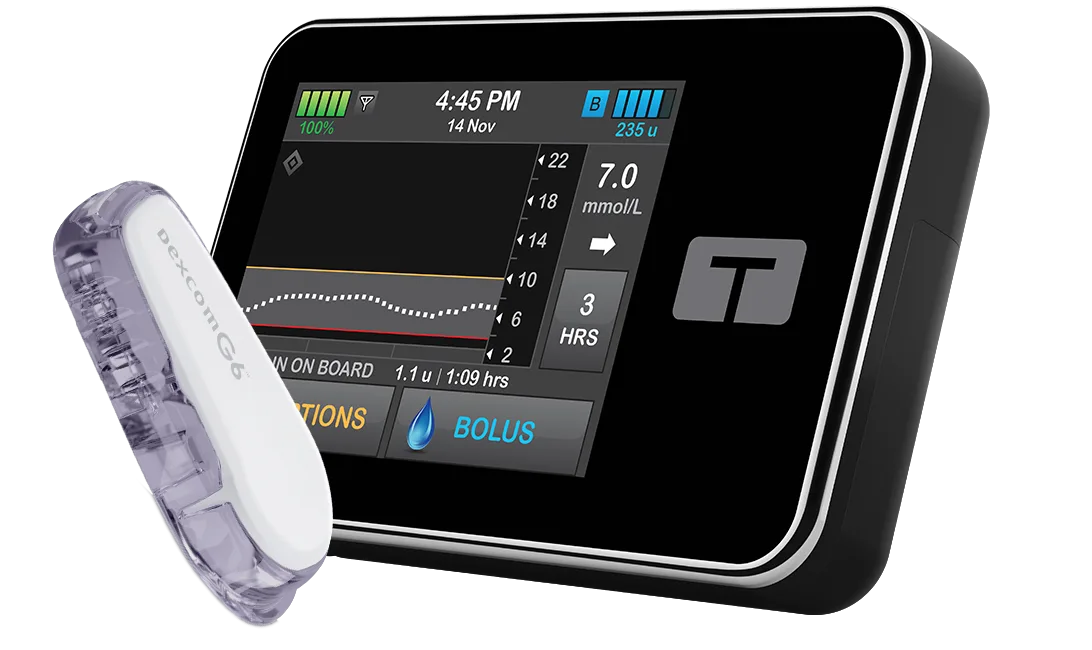 Basal-IQ Technology with Dexcom G6 CGM