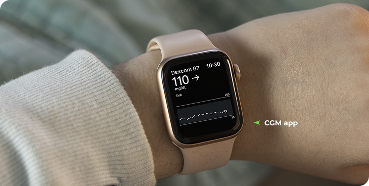 Dexcom G7 CGM app on Apple Watch