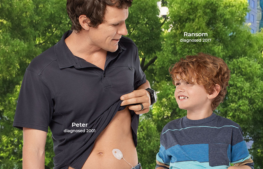 Insulin Pump Infusion Sets | Tandem Diabetes Care