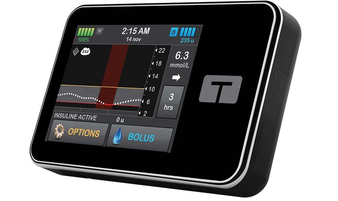 t:slim X2 Insulin Pump with Control-IQ Technology and Sleep Activity