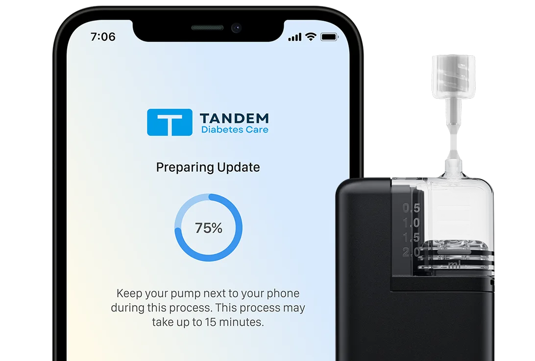 Tandem Mobi System Software Update Status
