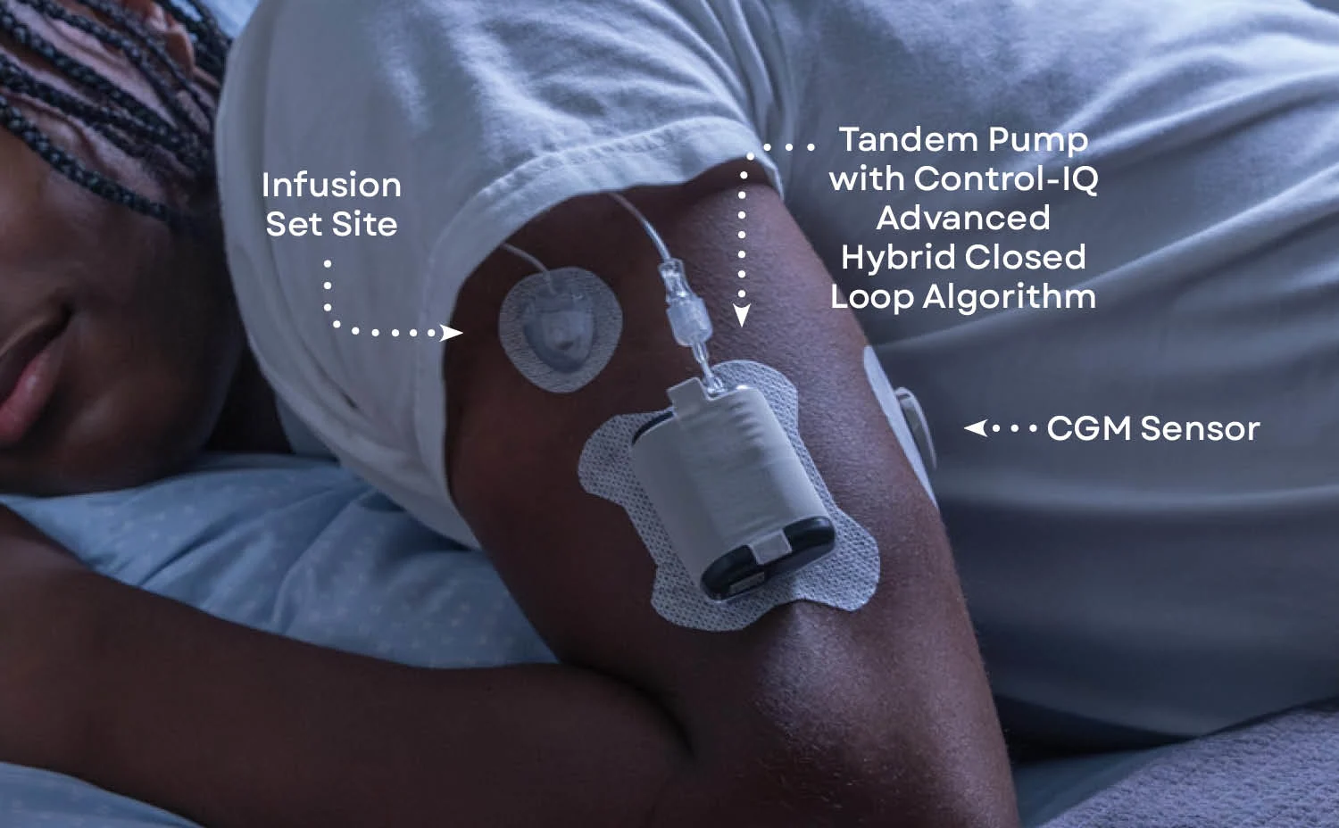 tandem-mobi-system-illustration-1500x928