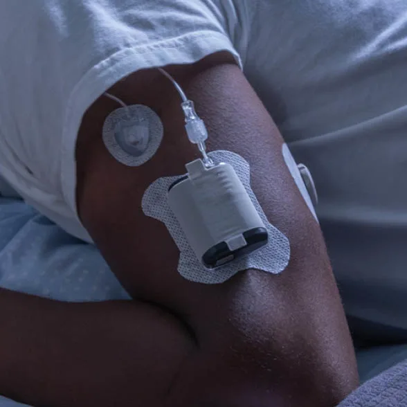 What is an Automated Insulin Delivery System?