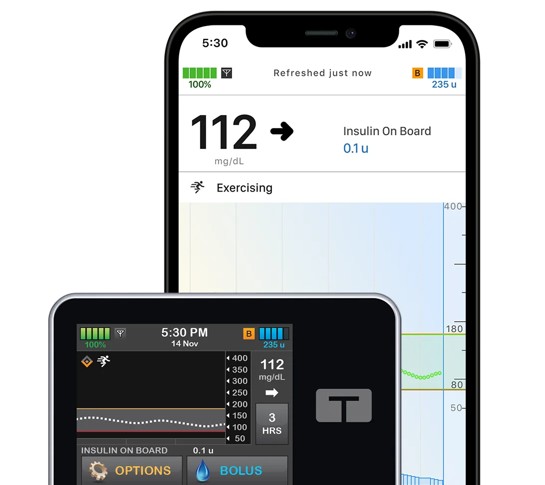 t:slim X2 insulin pump with mobile app