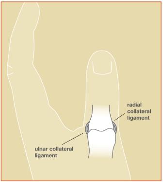 sprained thumb bpc-157 Understanding injury (UCL): Causes, symptoms, treatment, and recovery Peptide BPC-157 - Does It
