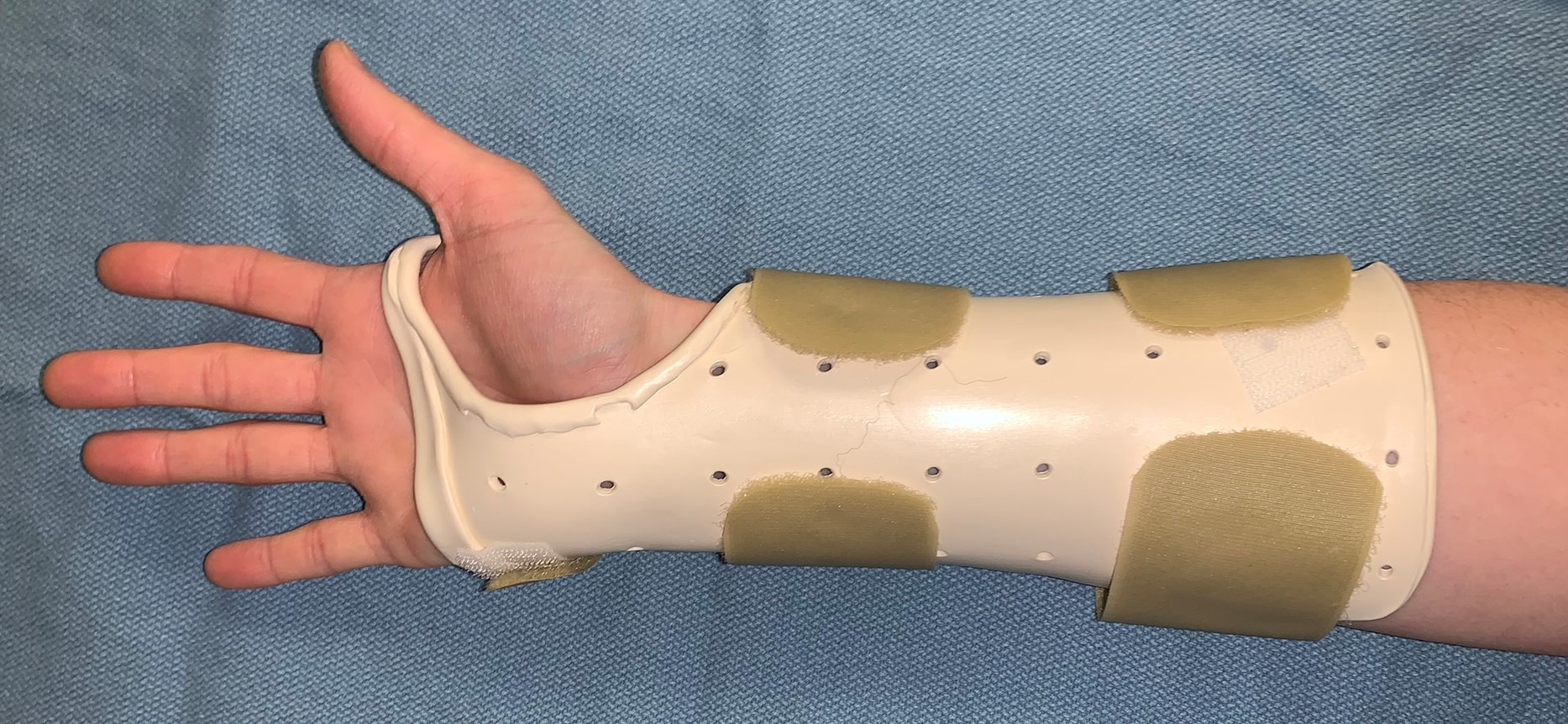 Dressings After Hand Injury or Surgery: What Are Dressing Types? | The Hand  Society