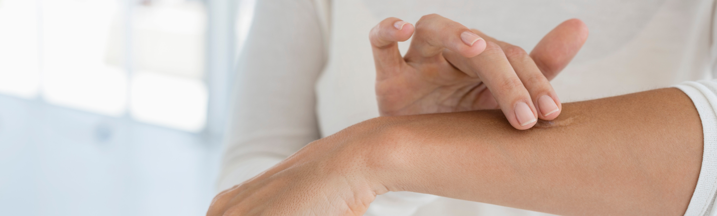 Person applying antibiotic ointment on their arm