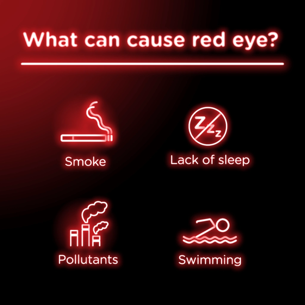 Red eye may be caused by smoke, lack of sleep, and swimming