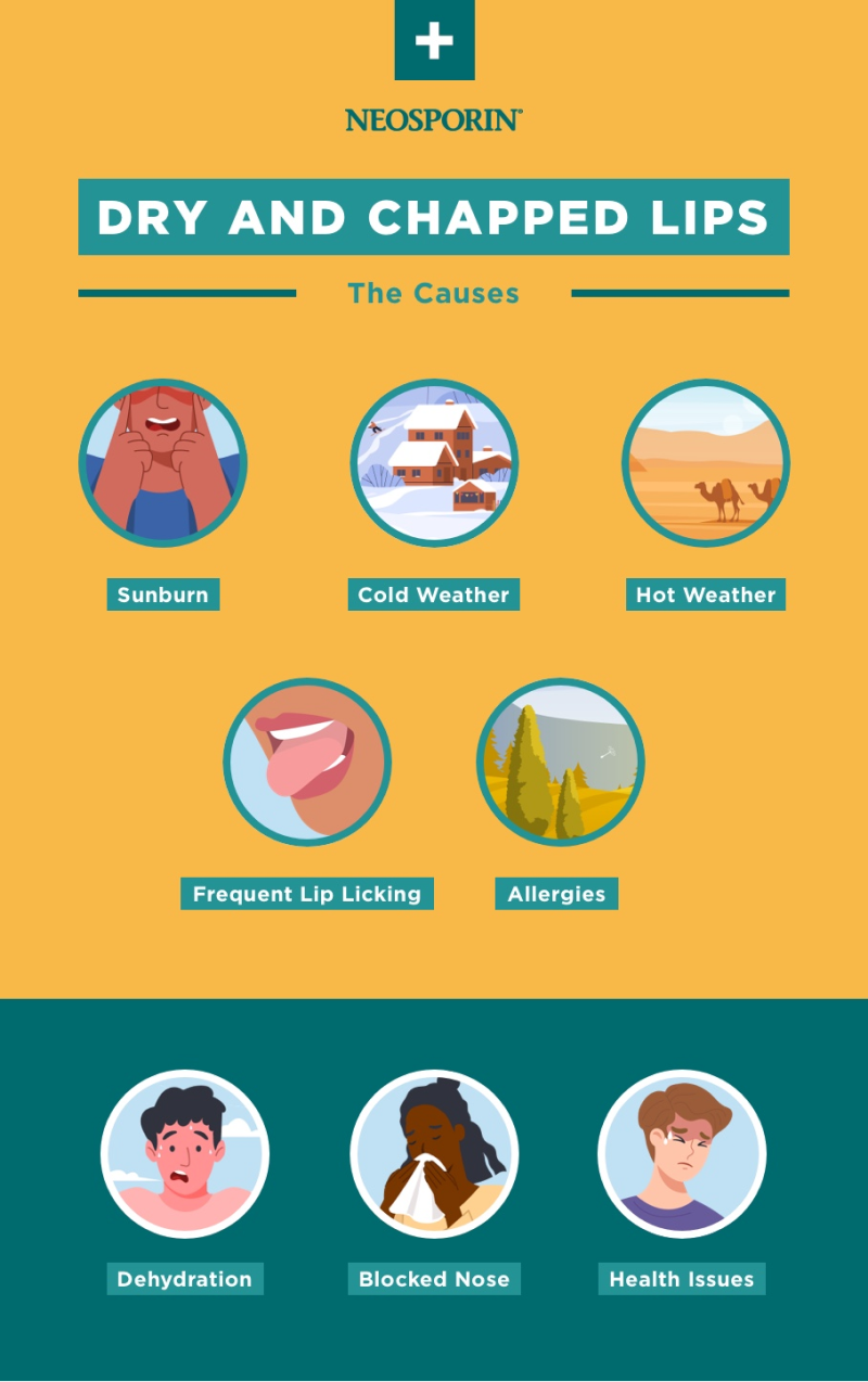 Infographic by Neosporin showing causes of dry and chapped lips: sunburn, cold weather, hot weather, frequent lip licking, allergies, dehydration, blocked nose, and health issues.