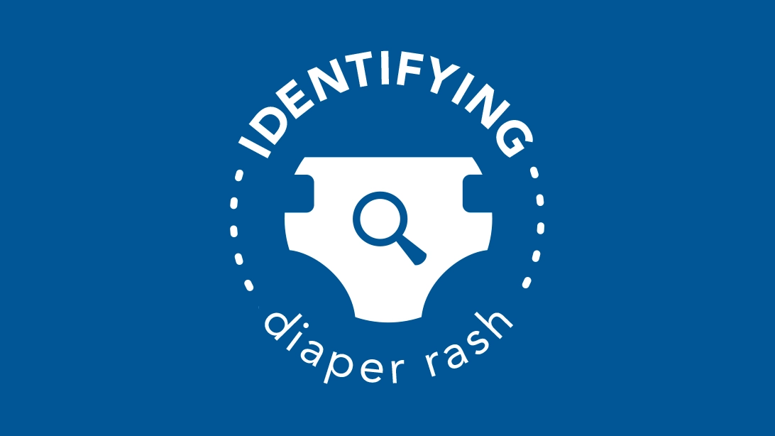 Blue circular badge with the text 'IDENTIFYING diaper rash' surrounding a white diaper icon with a magnifying glass symbol in the center.