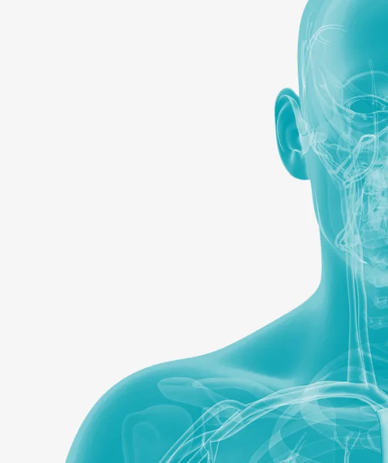 Ischemic Stroke and Carotid Artery Disease