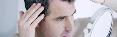 Man looking at his thinning hair in the mirror prior to undergoing a hair transplant.