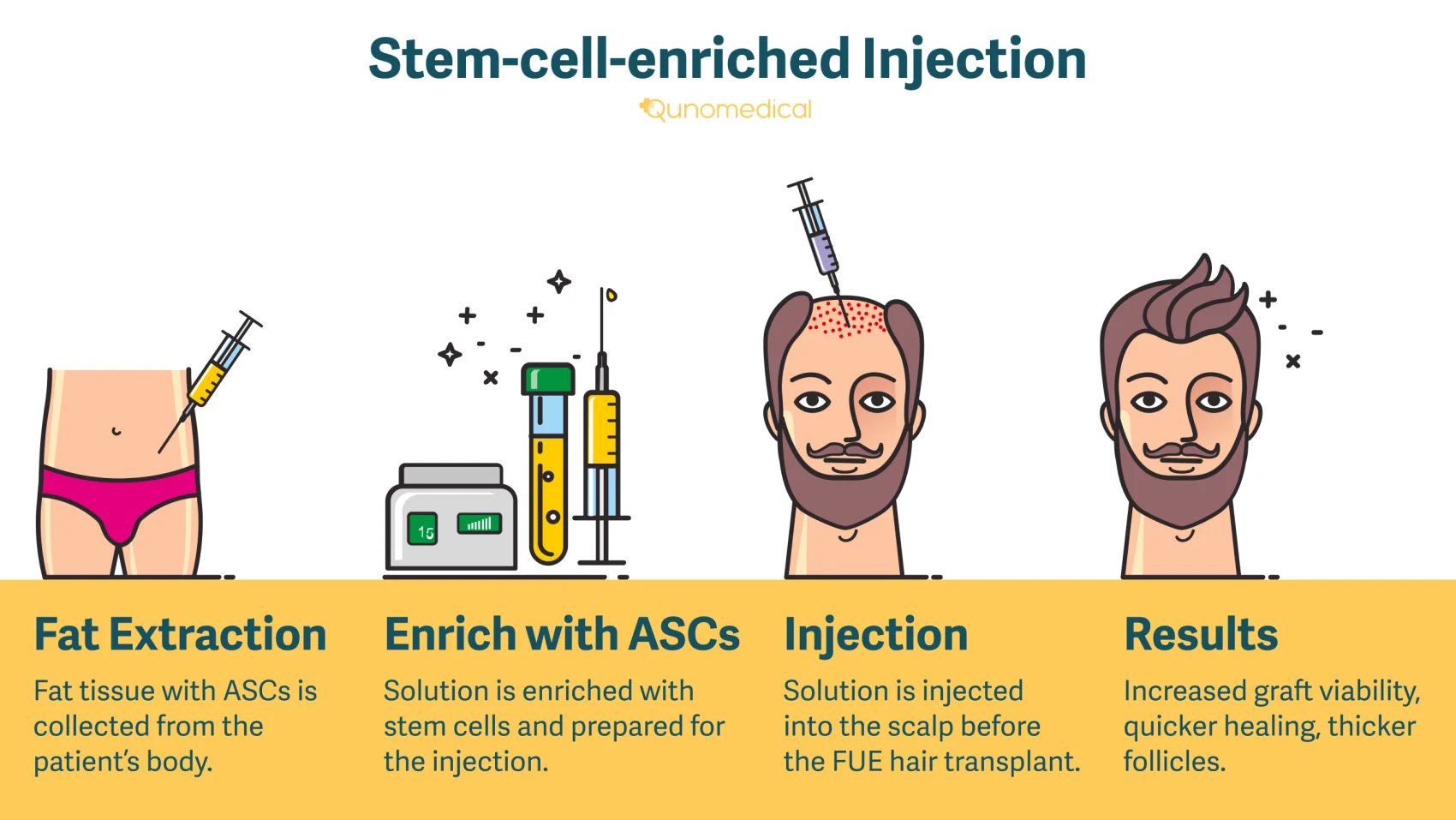 stemcellenrichedInjection_Image