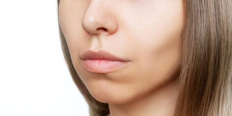 Buccal Fat Removal Banner Image