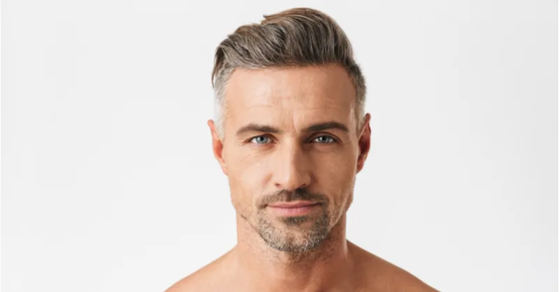 Homme avec cheveux denses et épais après une opération de greffe de cheveux.