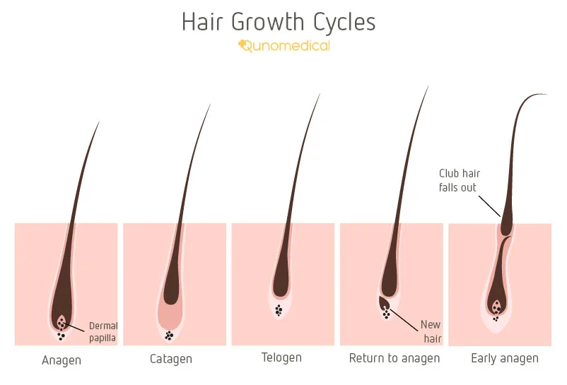 EN image 2 for Hair Loss Treatment Options - Extensive Guide
