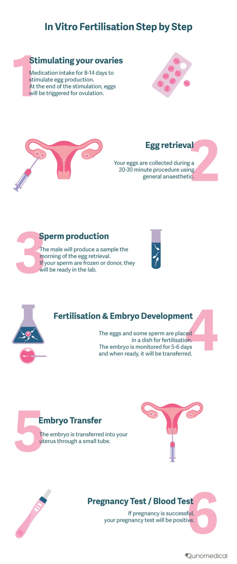 In-vitro-fertilisation-step-by-step-infographic