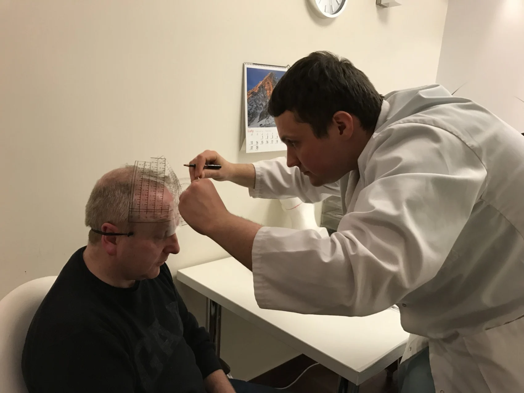BannerImage_Eamon’s Hair Transplant Journey - Part III: After Treatment