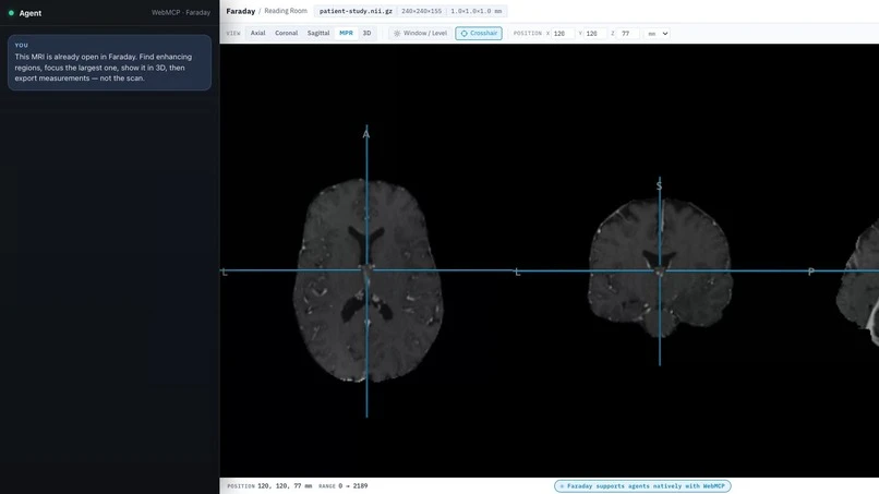 Faraday research viewer displaying brain scan slices.